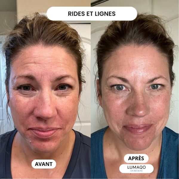 Lumaqo - Collagène Repair Lift Pro