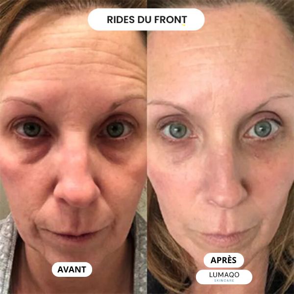Lumaqo - Collagène Repair Lift Pro