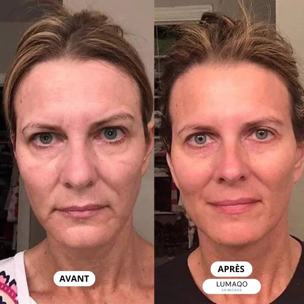 Lumaqo - Collagène Repair Lift Pro