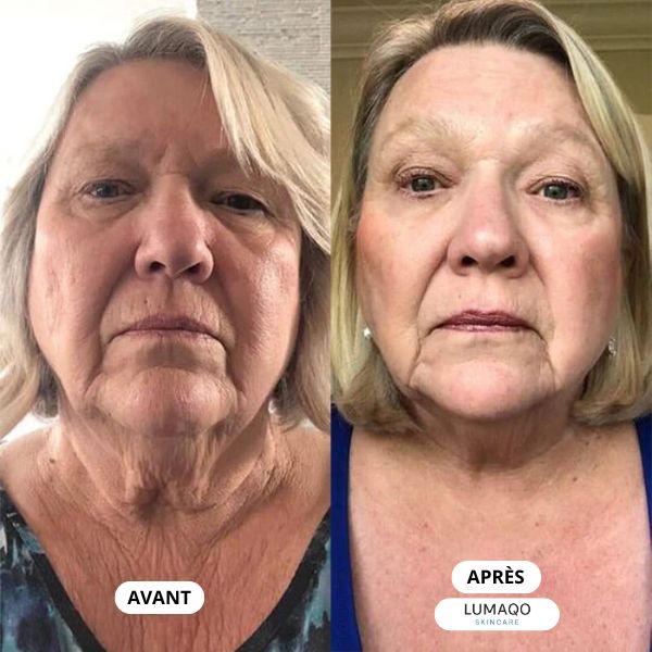 Lumaqo - Collagène Repair Lift Pro